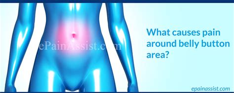 What Causes Belly Button Hernia