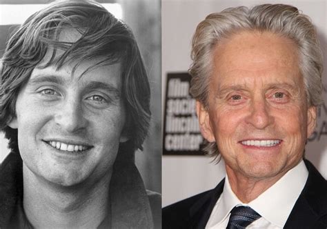 Michael Douglas Before And After Plastic Surgery Face