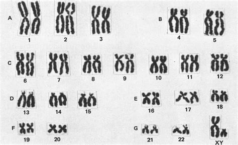 Giemsa Chromosome
