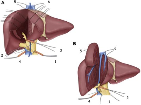 Selective Venous Occlusions For Reducing Blood Loss During Right