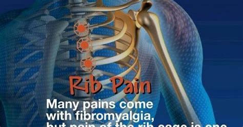 They articulate with the vertebral column posteriorly, and terminate anteriorly as cartilage if two or more fractures occur in two or more adjacent ribs, the affected area is no longer under control of the thoracic muscles. Sometimes I get rib muscle cramps... OMG that hurts. *wow ...
