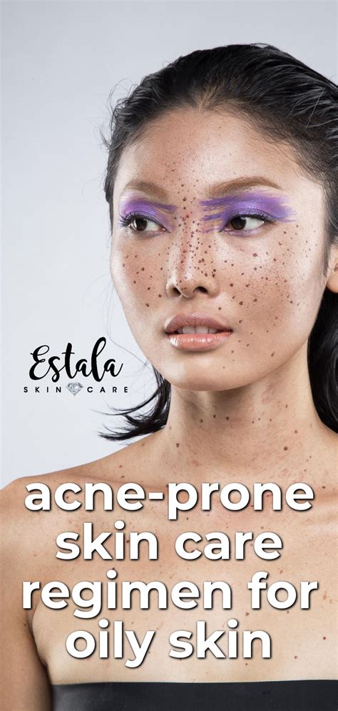 Acne Prone Skin Care Regimen For Oily Skin Try This Stress Acne