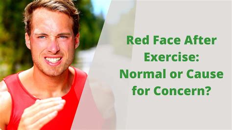 Why Do You Get Red Face After Exercise Fintys