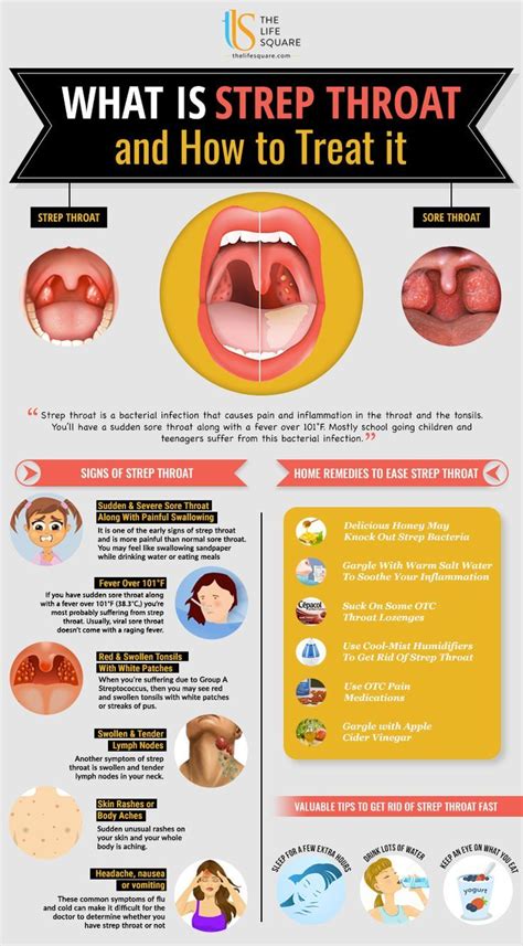 6 Warning Signs Of Strep Throat Ultimate Guide Strep Throat Signs Of Strep Throat Sore