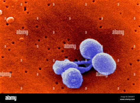 Una Micrografía Electrónica De Streptococcus Pneumoniae Bactrium