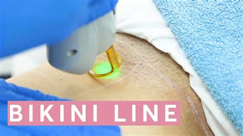 Laser Hair Removal Bikini This Is How It Works Youtube