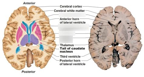 Brain Anatomy 3 Diagram Quizlet