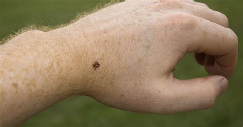 Researchers Discover New Tick Borne Disease Cbs News
