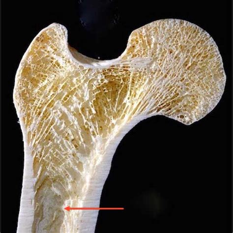 Cortical Bone Anatomy