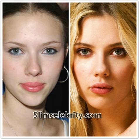Scarlett Johansson Plastic Surgery Before And After Photos Nose Job
