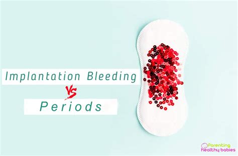 Implantation Bleeding Vs Periods Everything You Need To Know