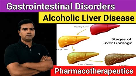 Alcoholic Liver Disease Gastrointestinal Disorders Youtube