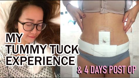My Tummy Tuck Experience And 4 Days Post Op Qanda Youtube