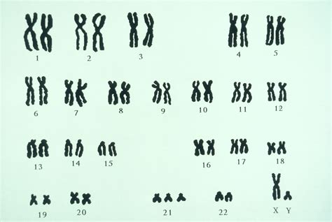 Scientists Find Its Possible To Silence Chromosome Responsible For