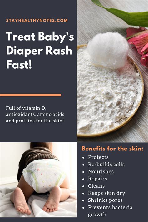 How To Treat Diaper Rash Quickly