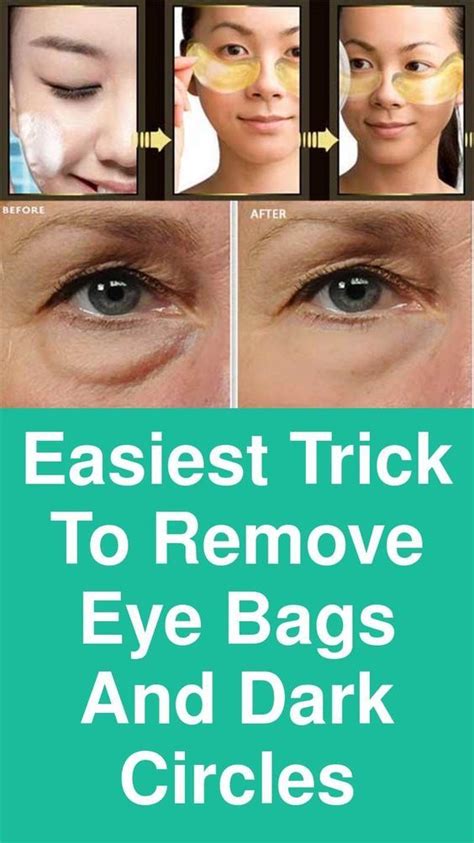 Easiest Trick To Remove Eye Bags And Dark Circles To Begin With Take Two Spoons And Put Them In