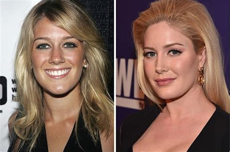 the hills then now see photos of how the cast has cha