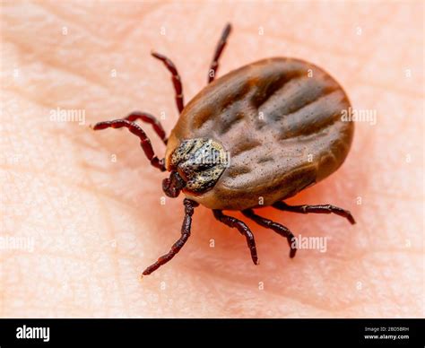 Encephalitis Insect Tick Crawling On Skin Encephalitis Virus Or Lyme