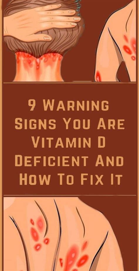 Feb 15, 2017 · objectives to assess the overall effect of vitamin d supplementation on risk of acute respiratory tract infection, and to identify factors modifying this effect. Pin on Health