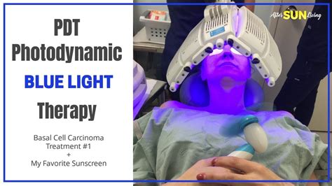 Pdt Photodynamic Blue Light Therapy Skin Cancer Treatment Basal