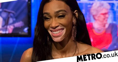Winnie Harlow Wants You To Know Shes Not Suffering From Vitiligo