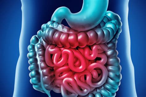 E Small Intestinal Bacterial Overgrowth Sibo Moonee Valley