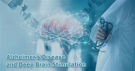 Alzheimers Disease And Deep Brain Stimulation
