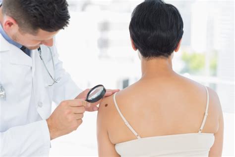Skin Cancer Treatment With Cryosurgery
