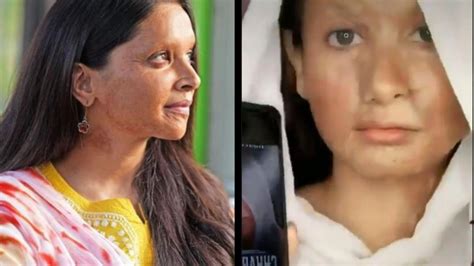 Deepika Padukone Throws TikTok Challenge On Her Chhapaak Acid Survivor
