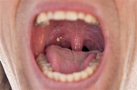 What Causes Swollen Tonsils In Dogs