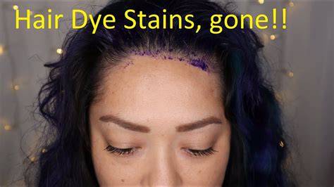 Now you can strip hair dye quickly and naturally! Remove Hair Dye Stains From Your Skin - YouTube