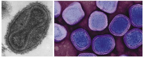 Smallpox Variola Major Codehealth