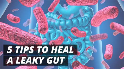 Why Gut Health Is Important How To Fix Leaky Gut Youtube
