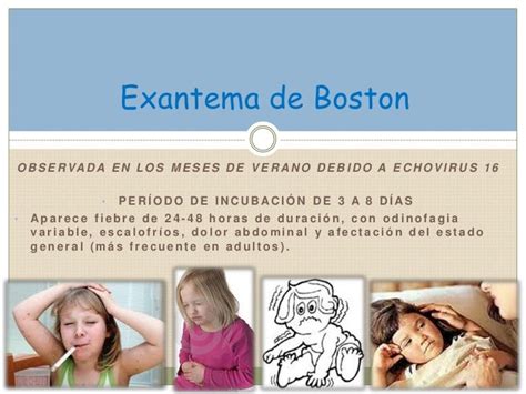 Exantema De Boston Coxsackie Echo9 Y 11 Enterovirus
