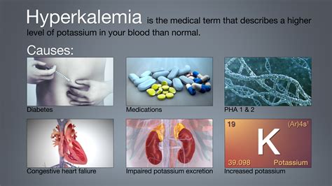 Hyperkalemia Symptoms Causes And Treatment