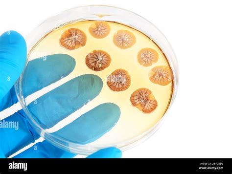 Fungi Microorganisms On Agar Plate In Laboratory Stock Photo Alamy