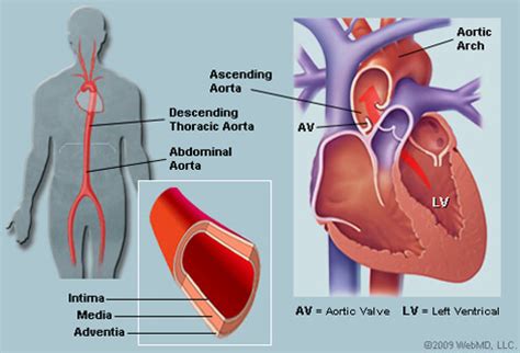 aorta picture image  rxlistcom