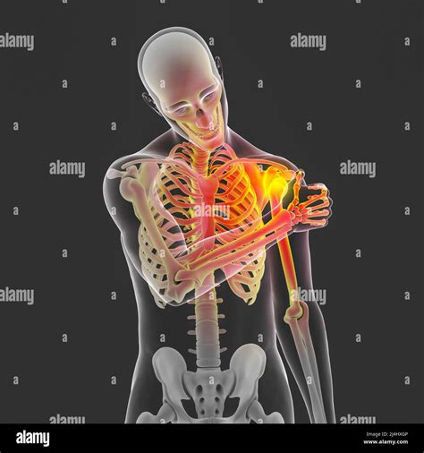 Painful Shoulder Illustration Stock Photo Alamy