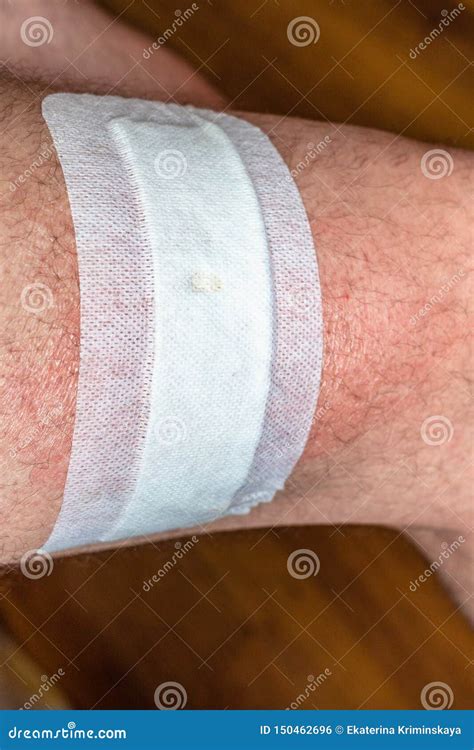 Hip Wound Sealed By White Adhesive Plaster Stock Photo Image Of
