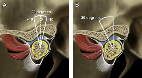 Mr Imaging Of The Temporomandibular Joint Magnetic Resonance Imaging