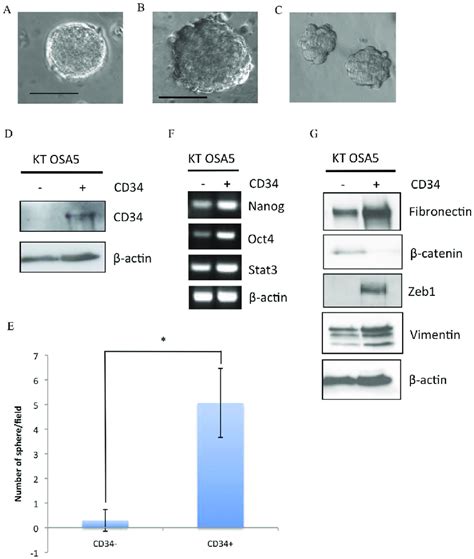 Characterisation Of Osteosarcoma Stem Cells Spheres Can Be Isolated