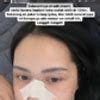 Foto Mawar Afi Oplas Di Korea Ganti Implan Hidung Yang Sudah