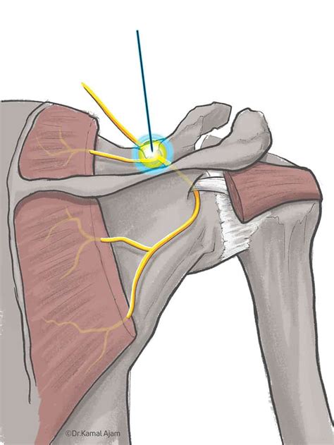 Shoulder Anatomy Nerves