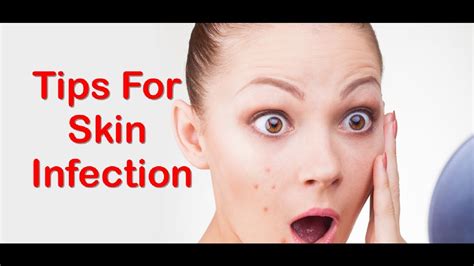 Top 10 Ways To Cure Bacterial Infection Of Skin Naturally Youtube