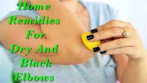 Home Remedies For Black Knees
