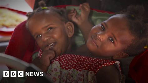 Conjoined Twins Marieme And Ndeye Ndiaye Are Living In The Uk Bbc News