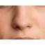 How Your Nose Got Its Shape According To Science