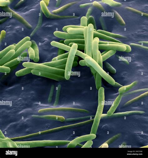Bacillus Sphaericus Farbig Scanning Electron Micrograph Sem Diese