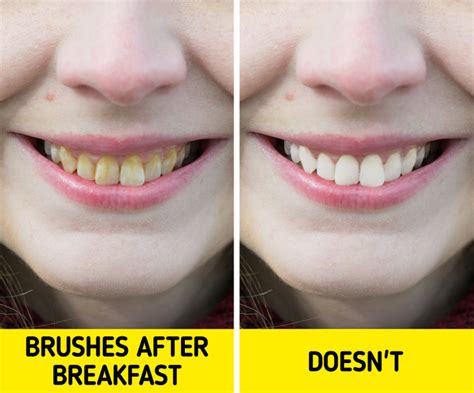 Why Its Better Not To Brush Your Teeth After Breakfast Bright Side