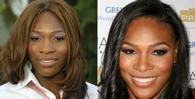 Serena williams looks really white in a recent photo! Elizabeth Aluko's Blog: Serena Williams And Her Nose Job, Lets See Before Meet After Photos ...